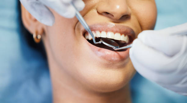 Best Emergency Broken Tooth Repair in Willamina, OR