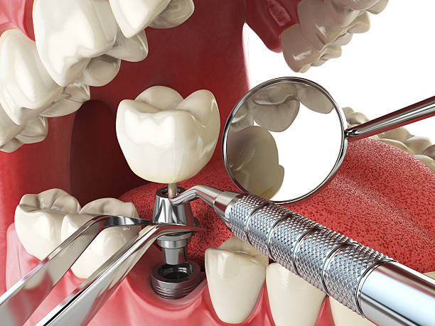 Best Emergency Broken Tooth Repair in Willamina, OR