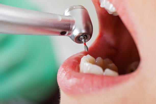Best Pediatric Emergency Dentist in Willamina, OR
